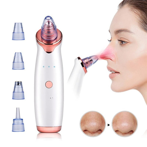 Vacuum Blackhead Remover Pimple Acne Removal Tool Skin Care Pore HairWorthy