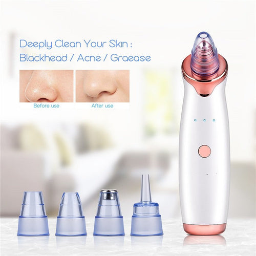 Vacuum Blackhead Remover Pimple Acne Removal Tool Skin Care Pore HairWorthy